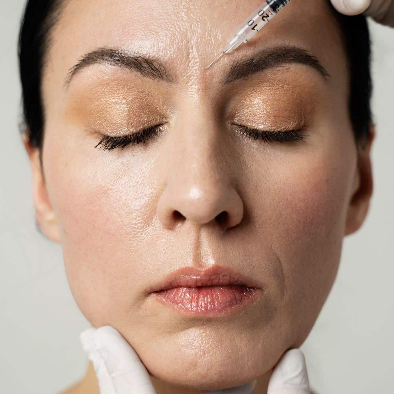 Tratamiento de Botox en CAPILART